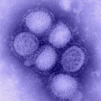 H1N1 virus