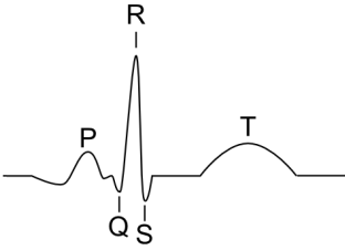 PQRST waves ECG
