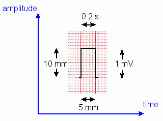 ecg - reference pulse