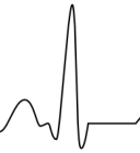 ECG