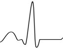 ECG