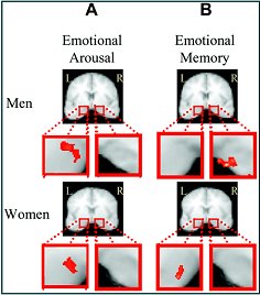 brain ssex differences